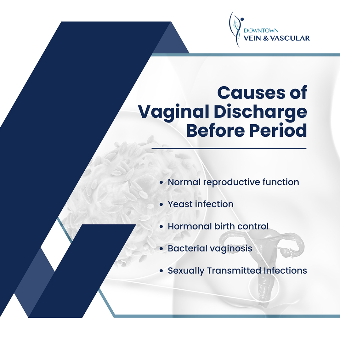 What Does Discharge Look Like Before Your Period?