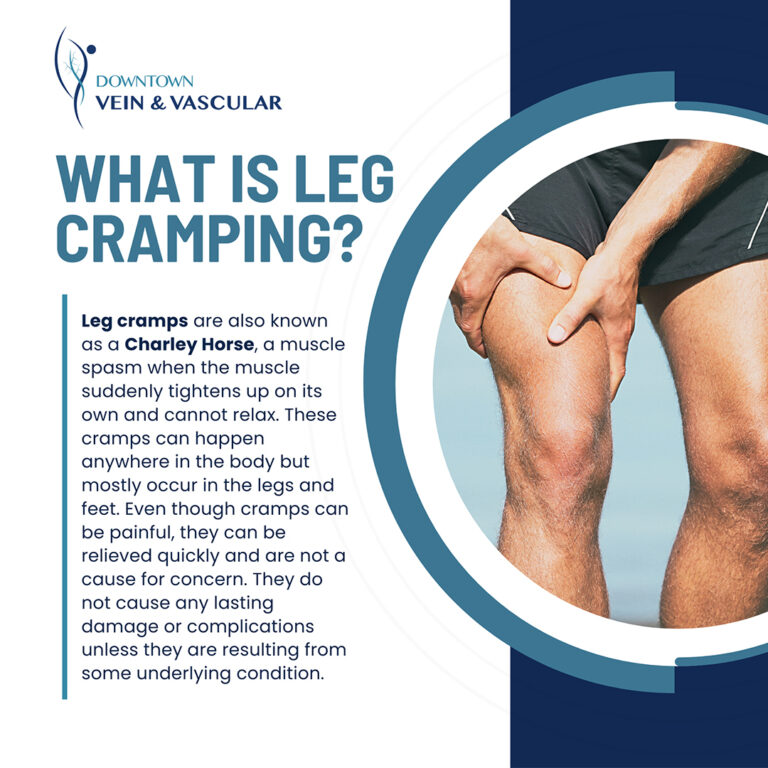 Why Leg Cramps Happen & When To Worry | Downtown Vein & Vascular