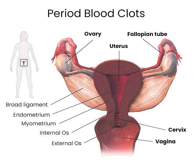 heavy blood clotting during periods