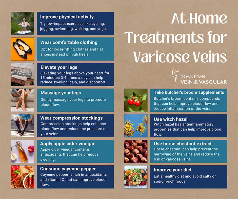 Natural Cure for Varicose Veins, Home Remedies to Treat Varicose Veins