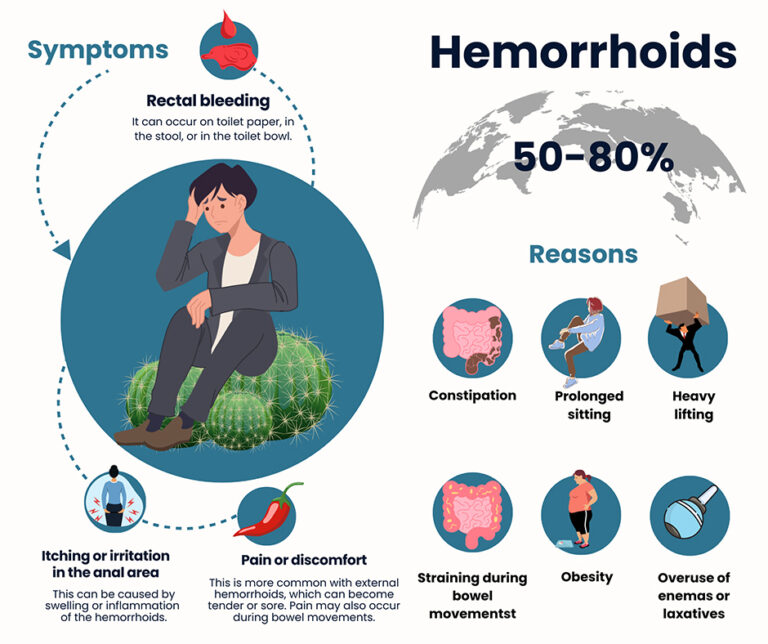 What Do Hemorrhoids Feel Like? - Downtown Vein & Vascular