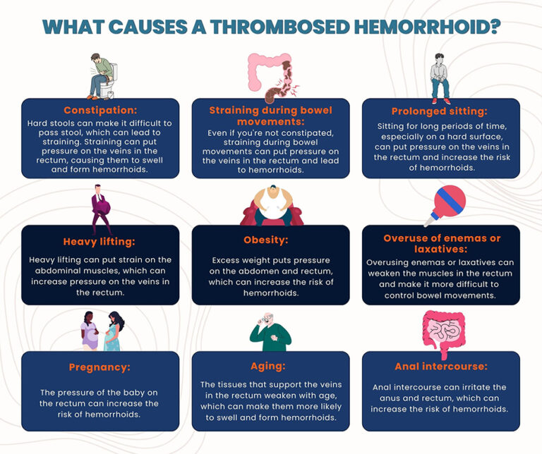 Top Signs of a Thrombosed Hemorrhoid Downtown Vein & Vascular